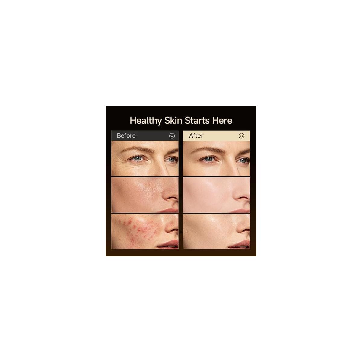 Red Light Mask Coupons - RebateKey