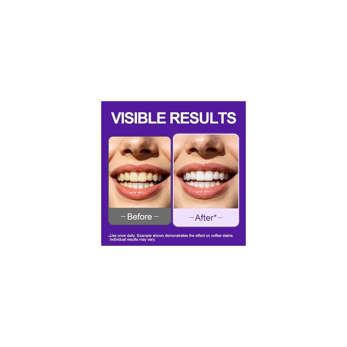 Teeth Whitening Strips 2 Coupon - RebateKey