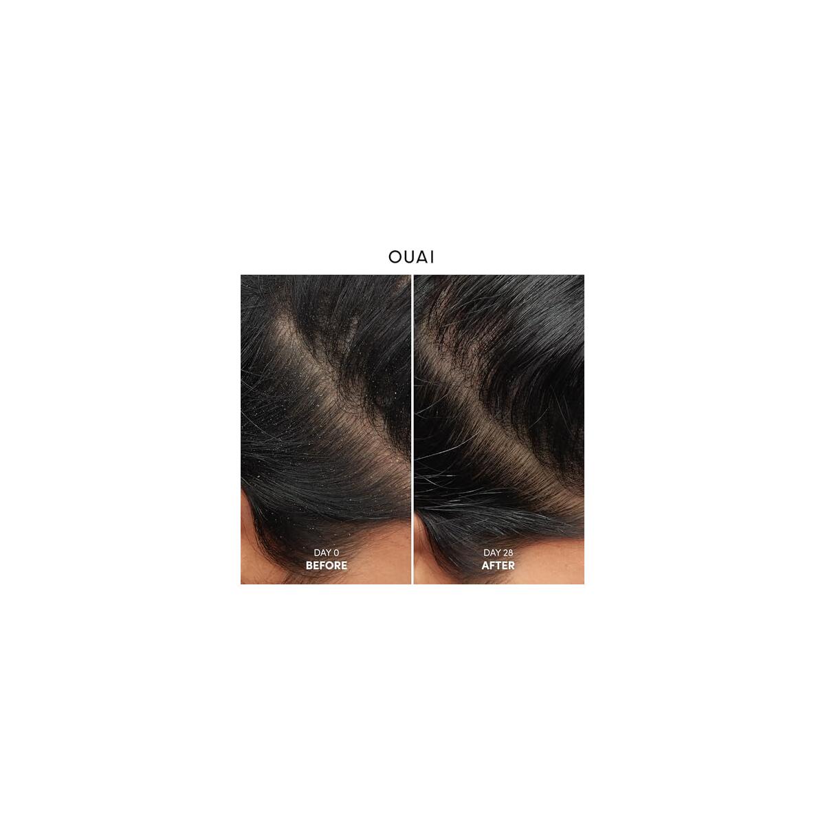 Ouai Anti Dandruff Shampoo Deals - RebateKey