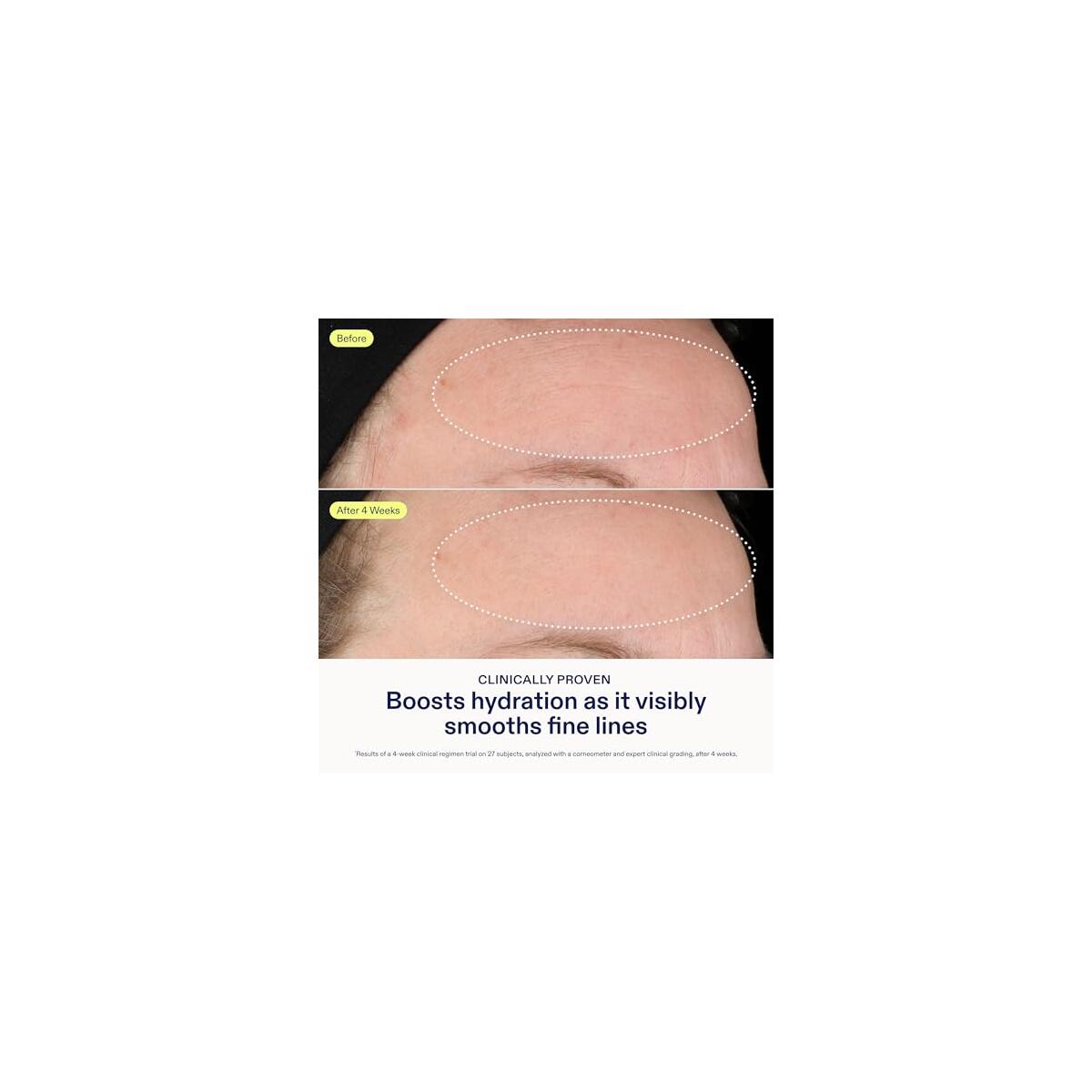 Skinfix Triple Lipid Hyaluronate Serum Deal - RebateKey