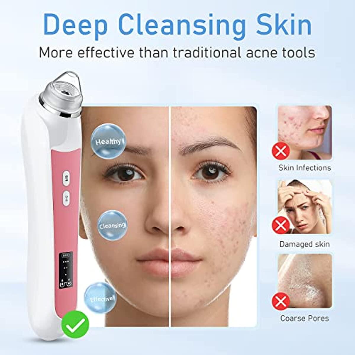 Blackhead Remover Vacuum Black 1 Promo Code - RebateKey