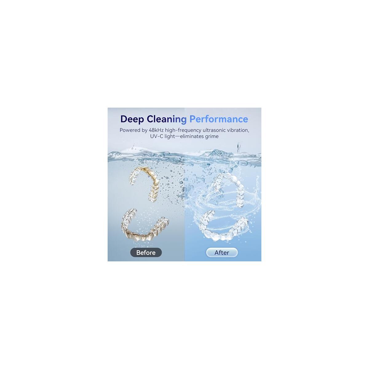 Ultrasonic Retainer Cleaner Machine 2 Deal - RebateKey