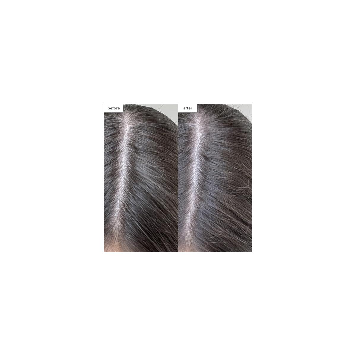 Briogeo Scalp Revival Charcoal Promo Code - RebateKey