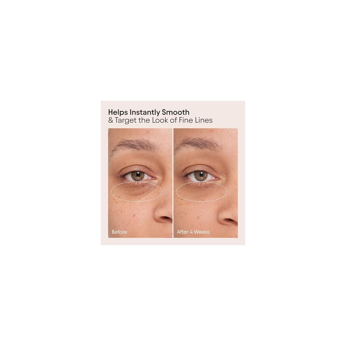 Alpyn Line Filling Eye Balm Coupons - RebateKey