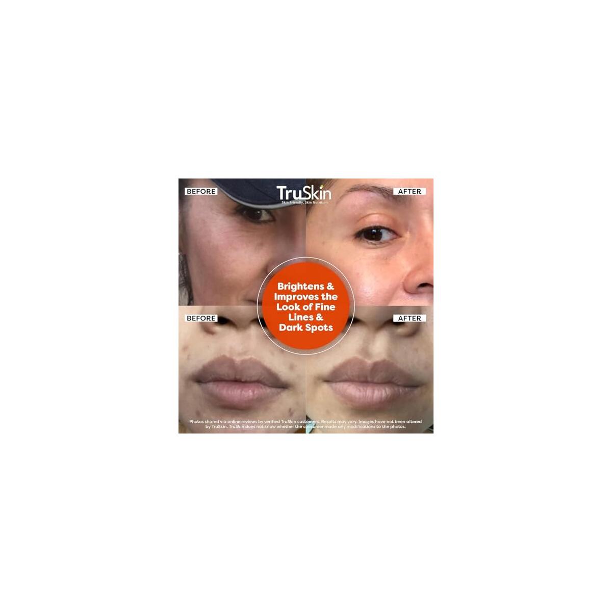 Truskin Vitamin C Deal - RebateKey