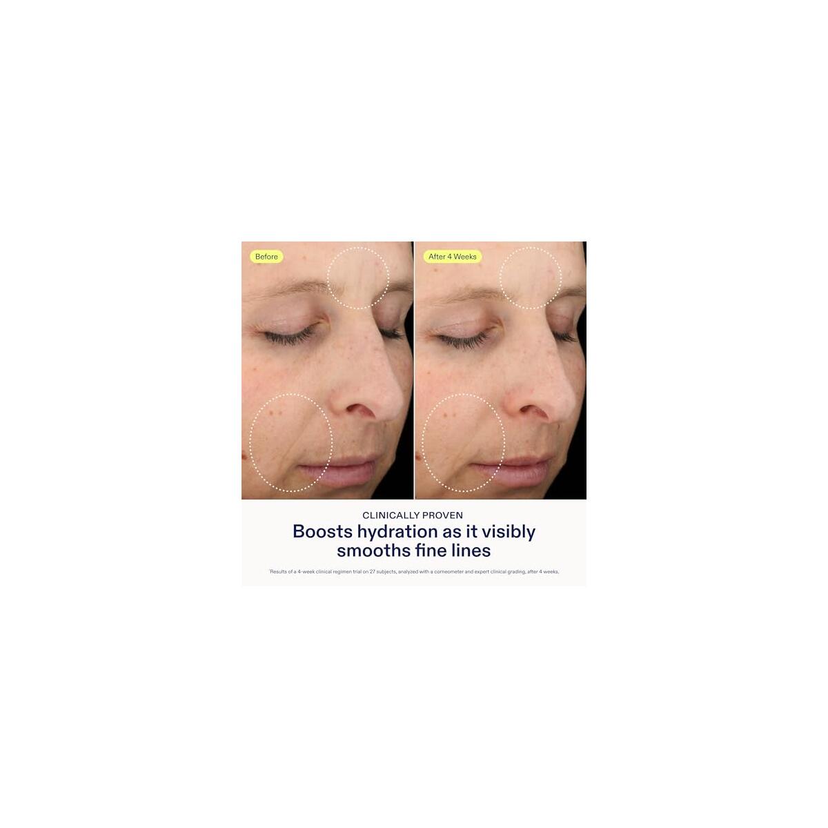 Skinfix Triple Lipid Hyaluronate Serum Deal - RebateKey