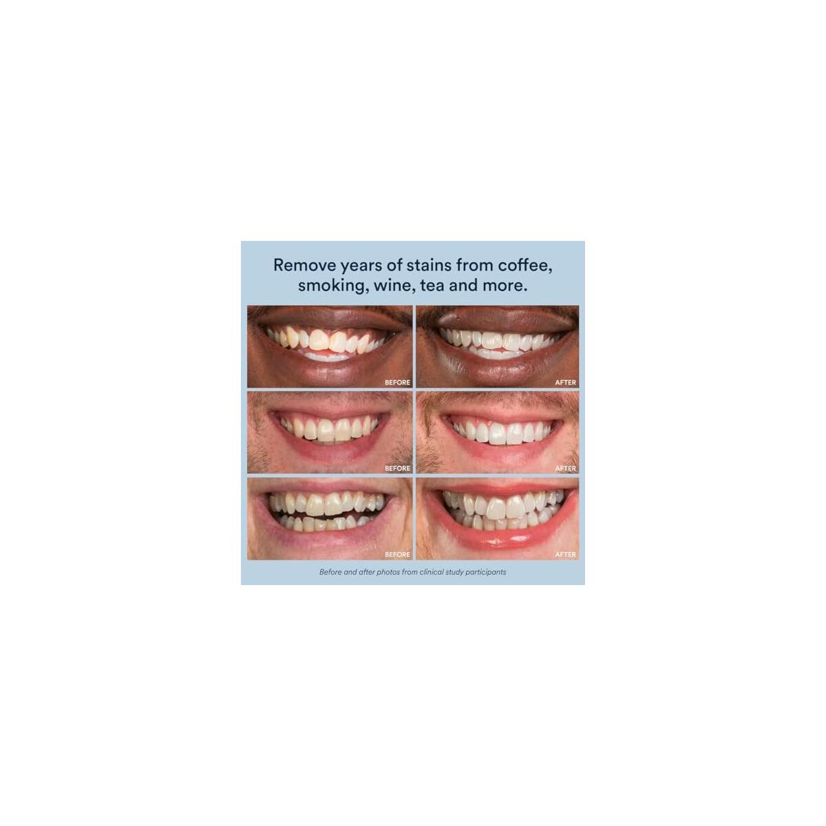 Auraglow Teeth Whitening 1 Promo Codes - RebateKey