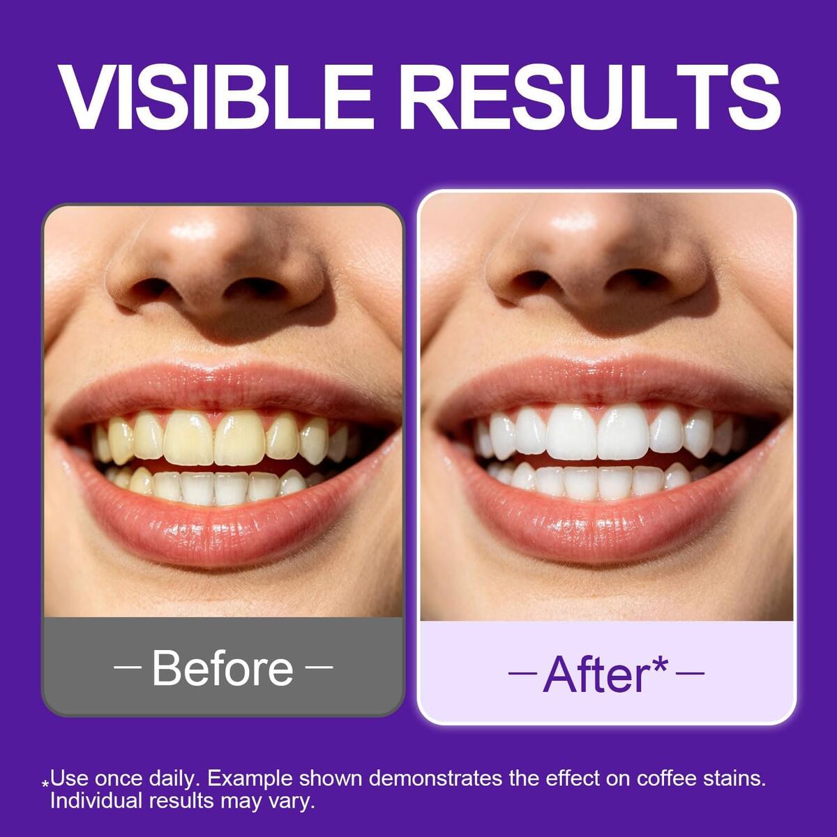 Teeth Whitening Strip Deal - RebateKey