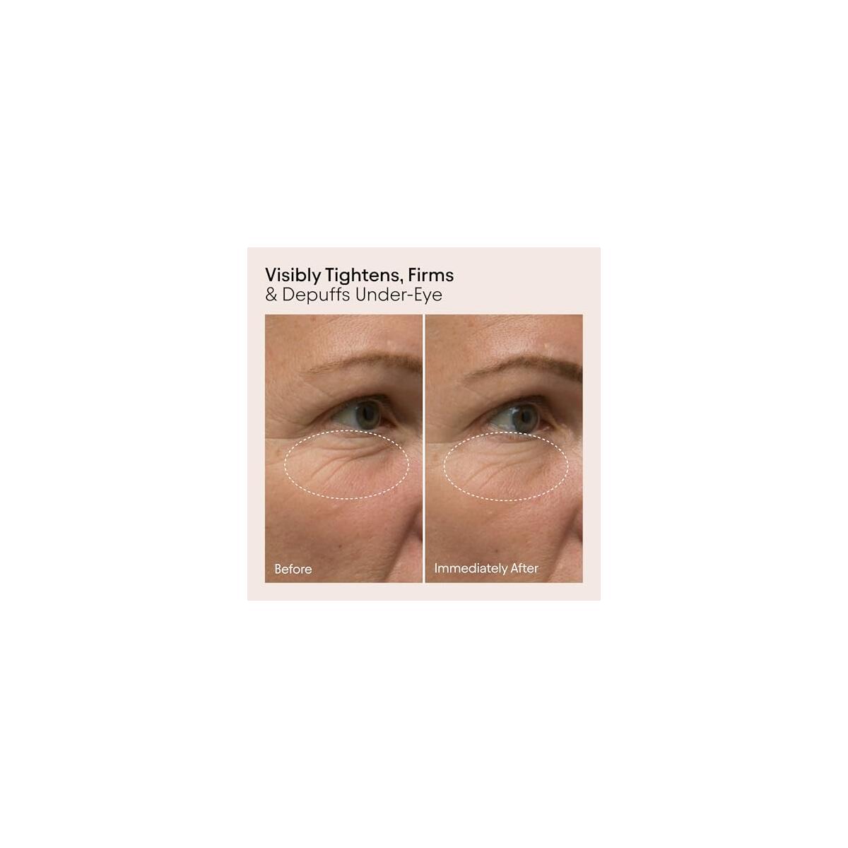 Alpyn Line Filling Eye Balm Coupons - RebateKey