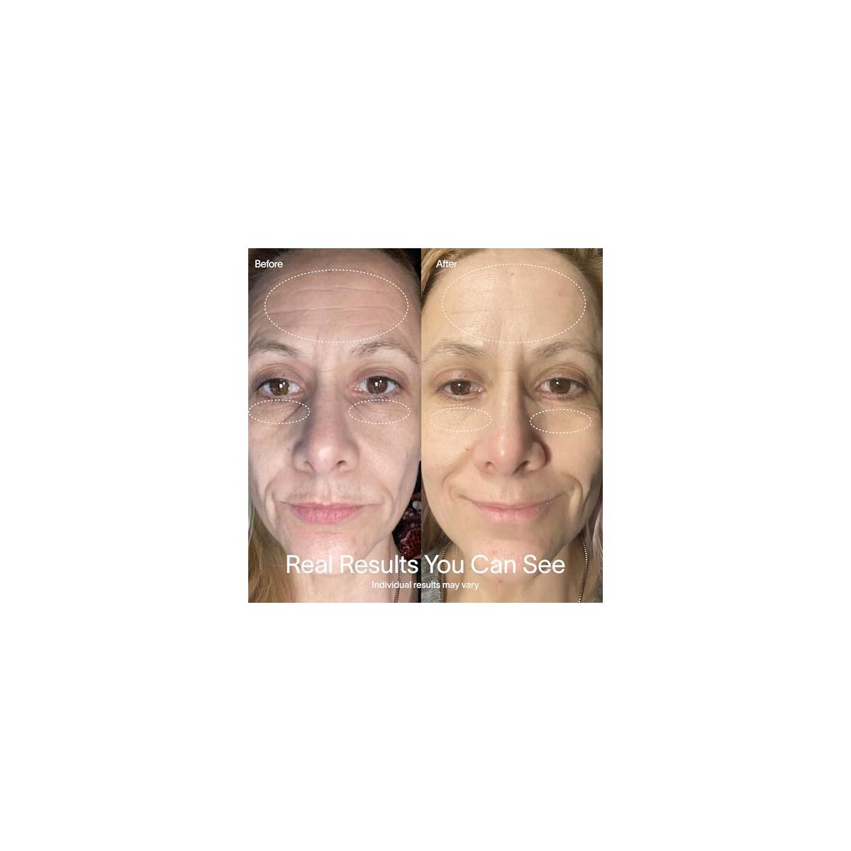 Solawave Red Light Therapy Coupons - RebateKey