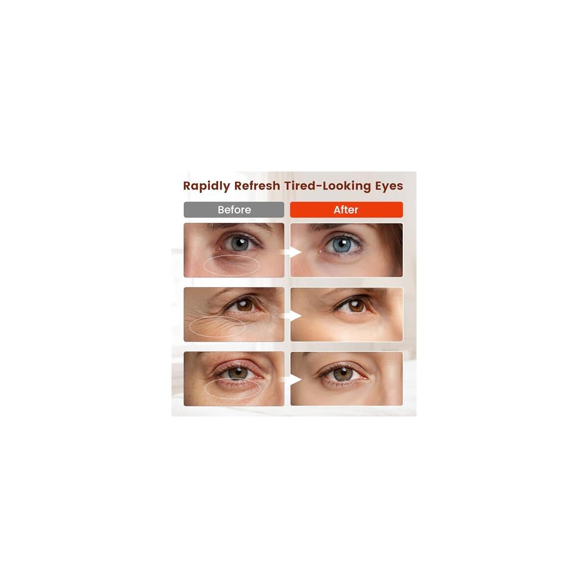 Viconor Red Light Deals - RebateKey