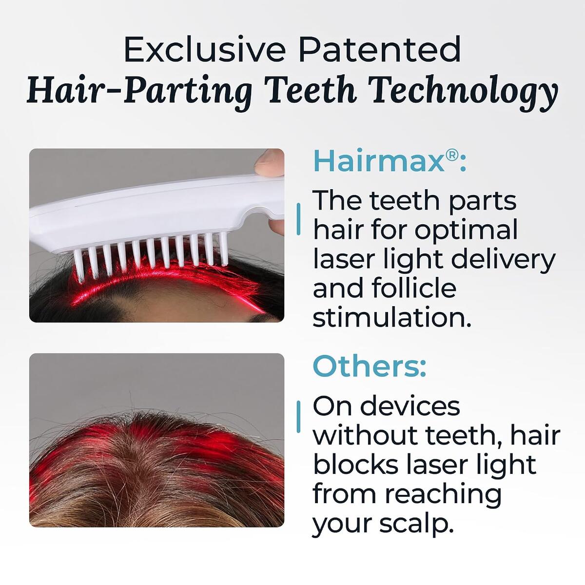 Hairmax Pro 12 Coupon - RebateKey