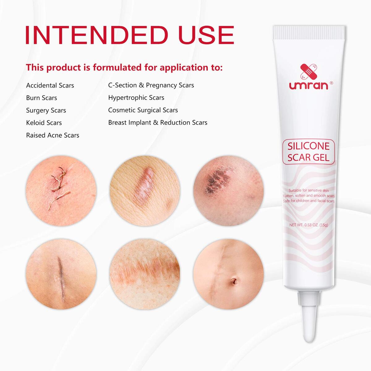 Umran Scar Removal Gel Deal - RebateKey