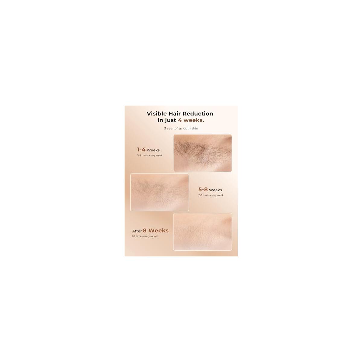 Laser Hair Removal 3 Coupons - RebateKey