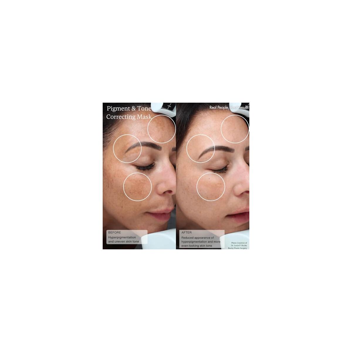 Sent Cysteamine Hsa Pigment Promo Codes - RebateKey