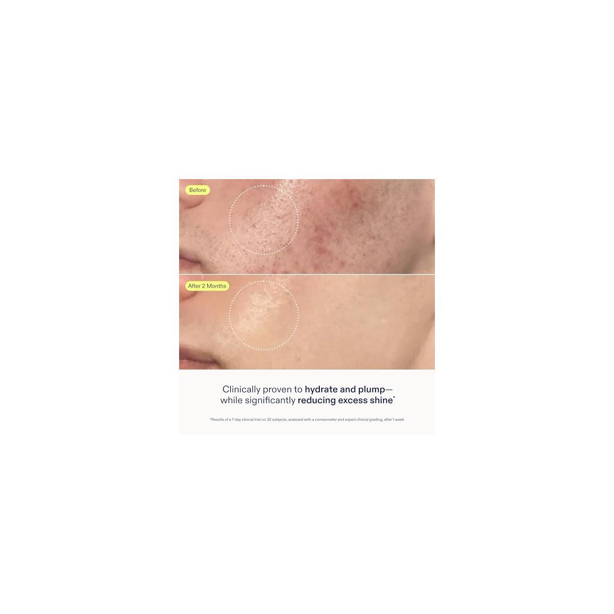 Skinfix Skin Barrier Promo Code - RebateKey