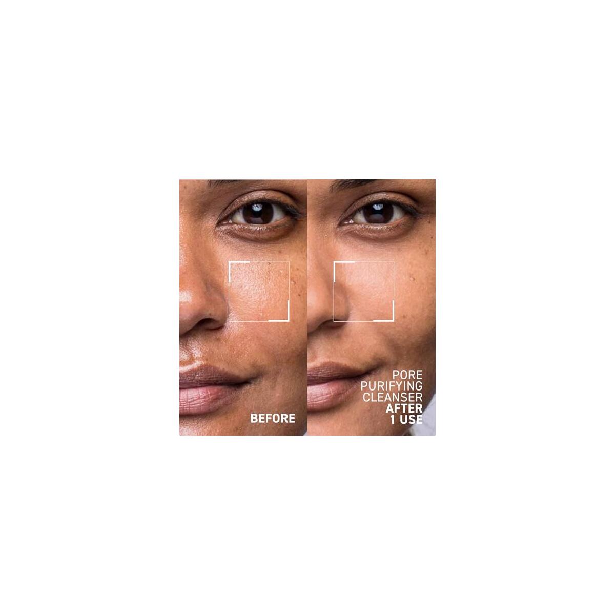 Dr Brandt Pores No Coupons - RebateKey