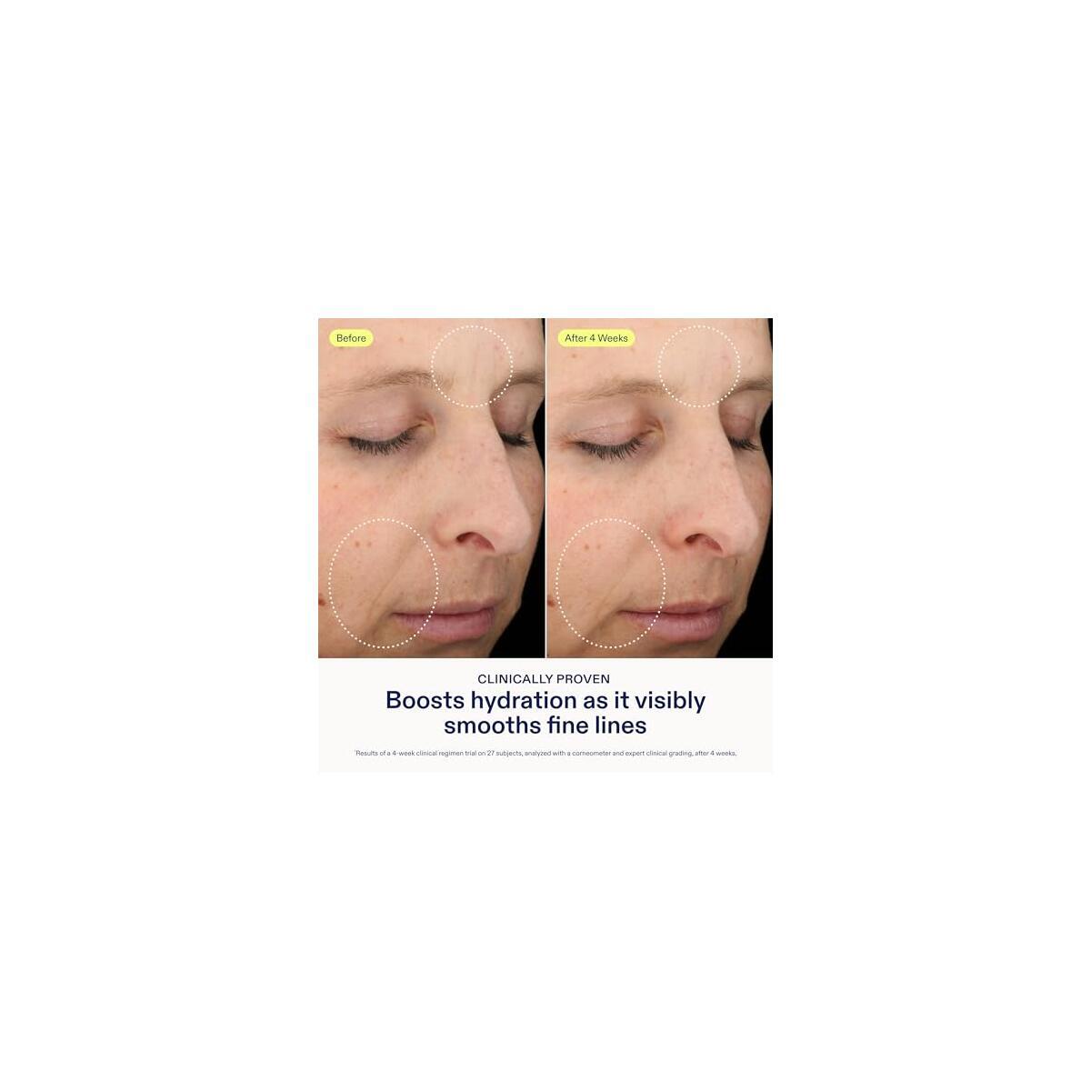 Skinfix Triple Lipid Hyaluronate Serum 1 Deals - RebateKey