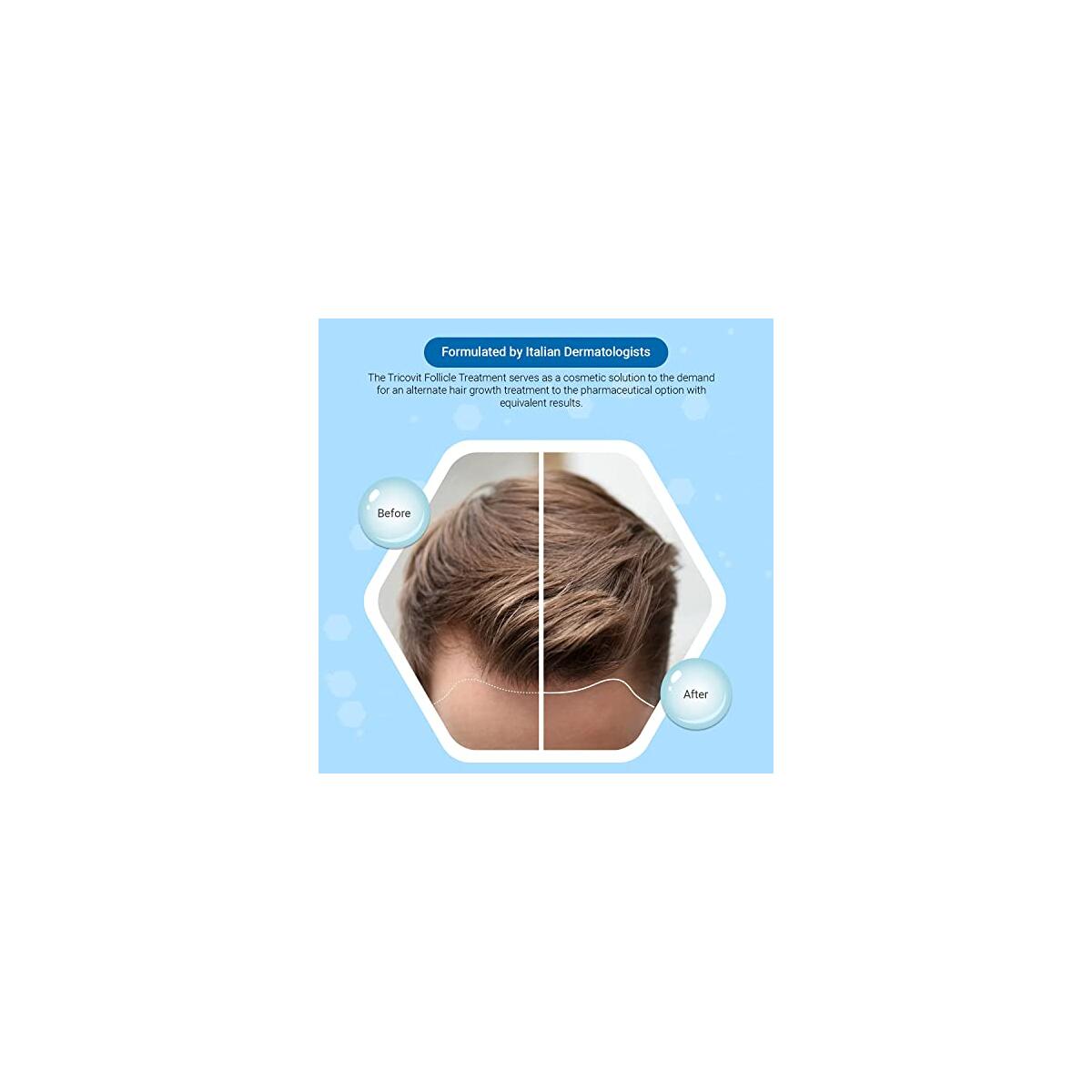 Tricovit Forte Hair Loss Deals - RebateKey