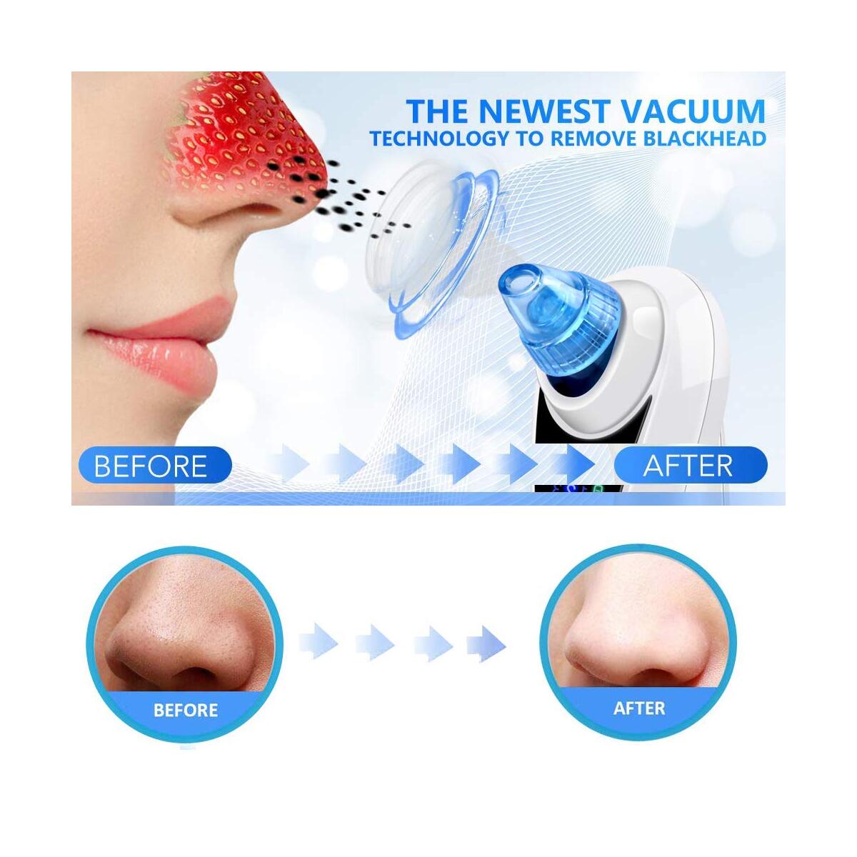 Blackhead Vacuum Promo Code - RebateKey