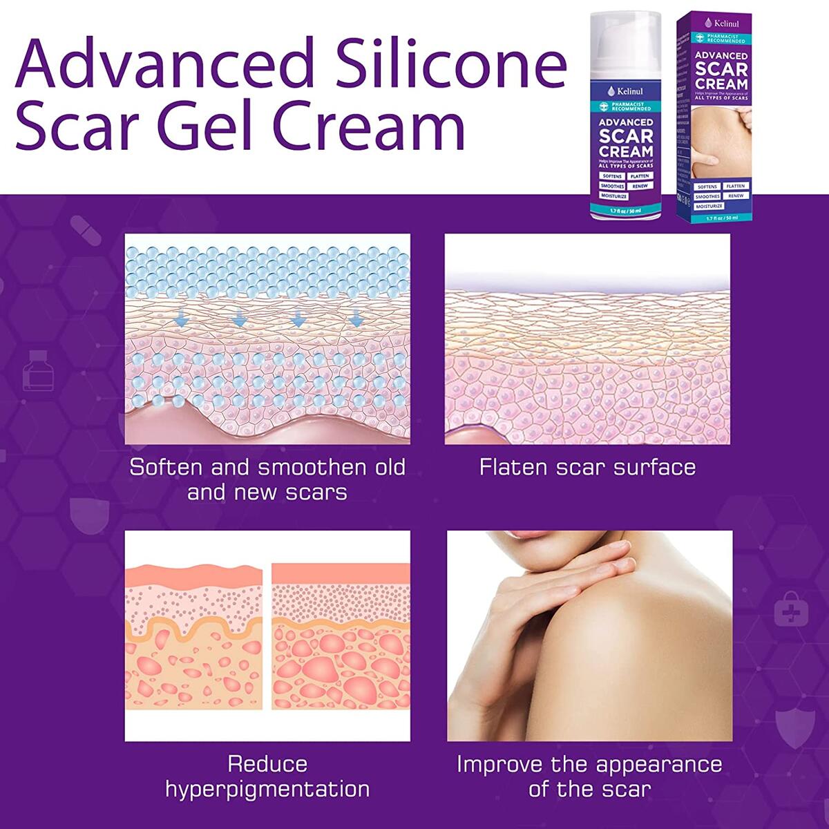 Soft Silicone Gel Cashback Rebate - RebateKey