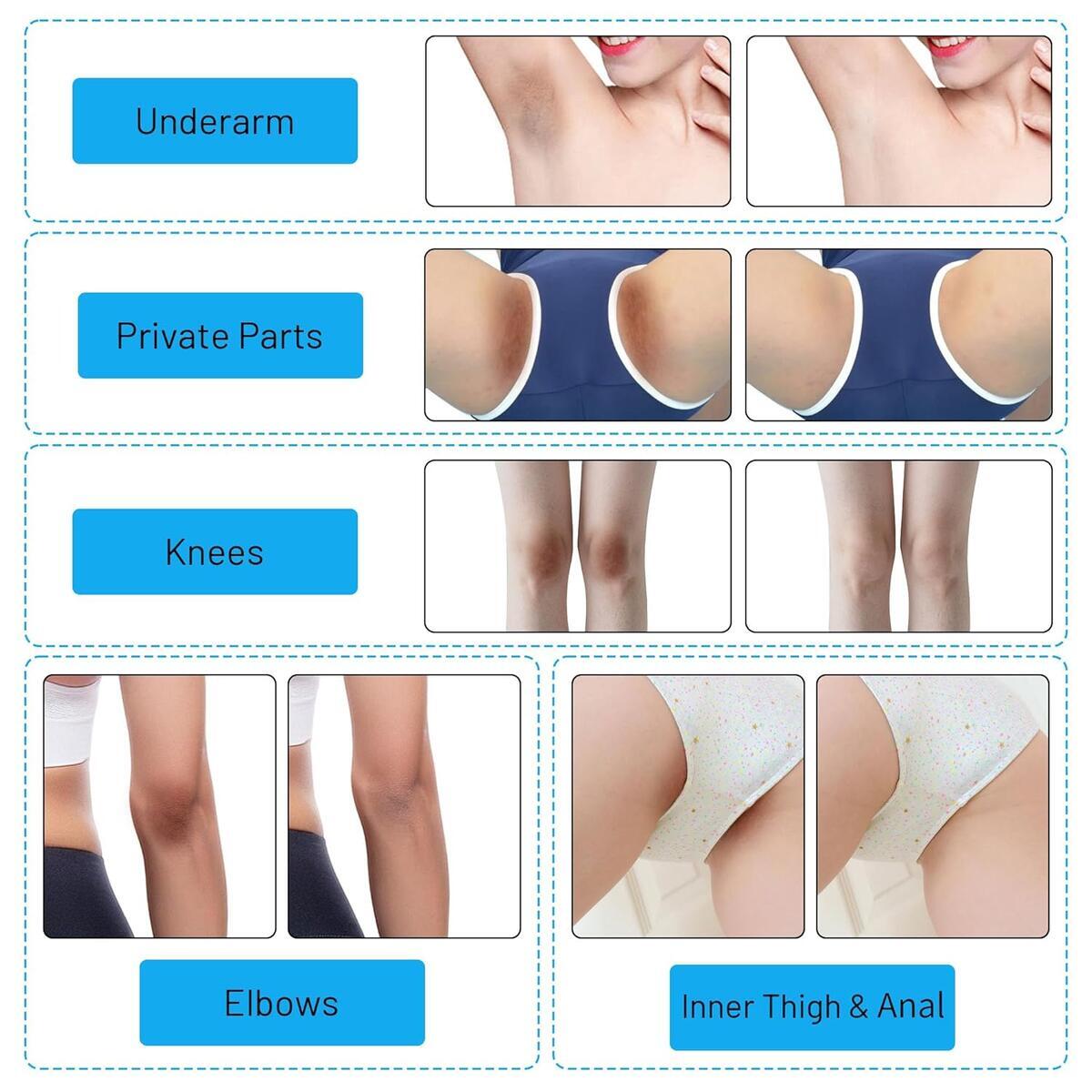 Skin Bleaching Cream 4 Cash Back - RebateKey