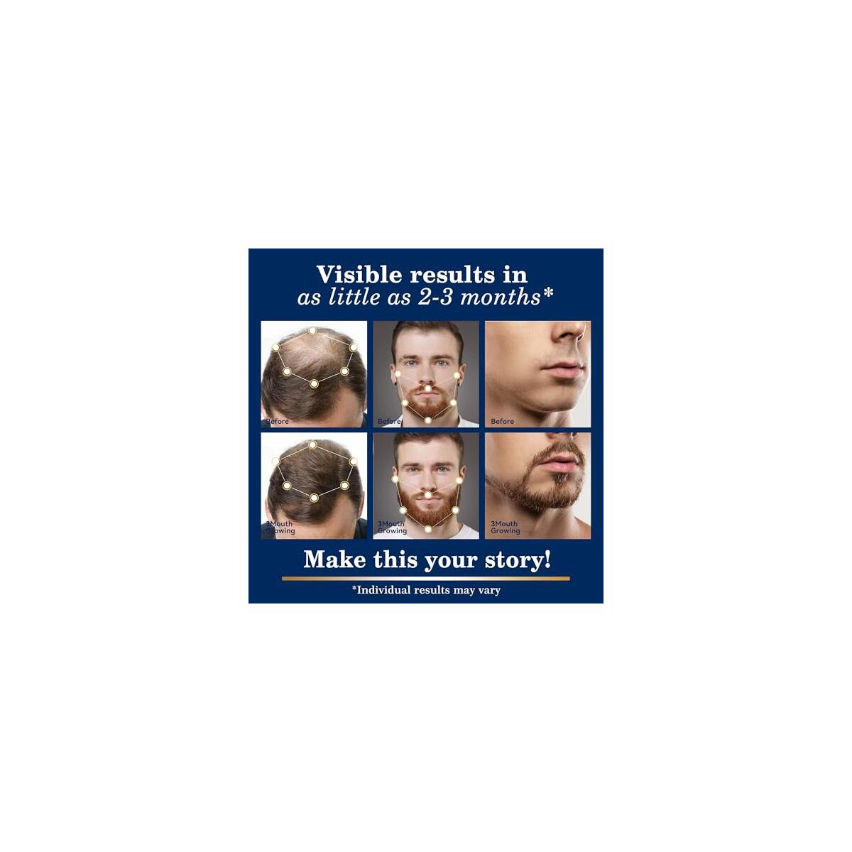 Minoxidil Spray 2pcs With Roller Rebate - RebateKey