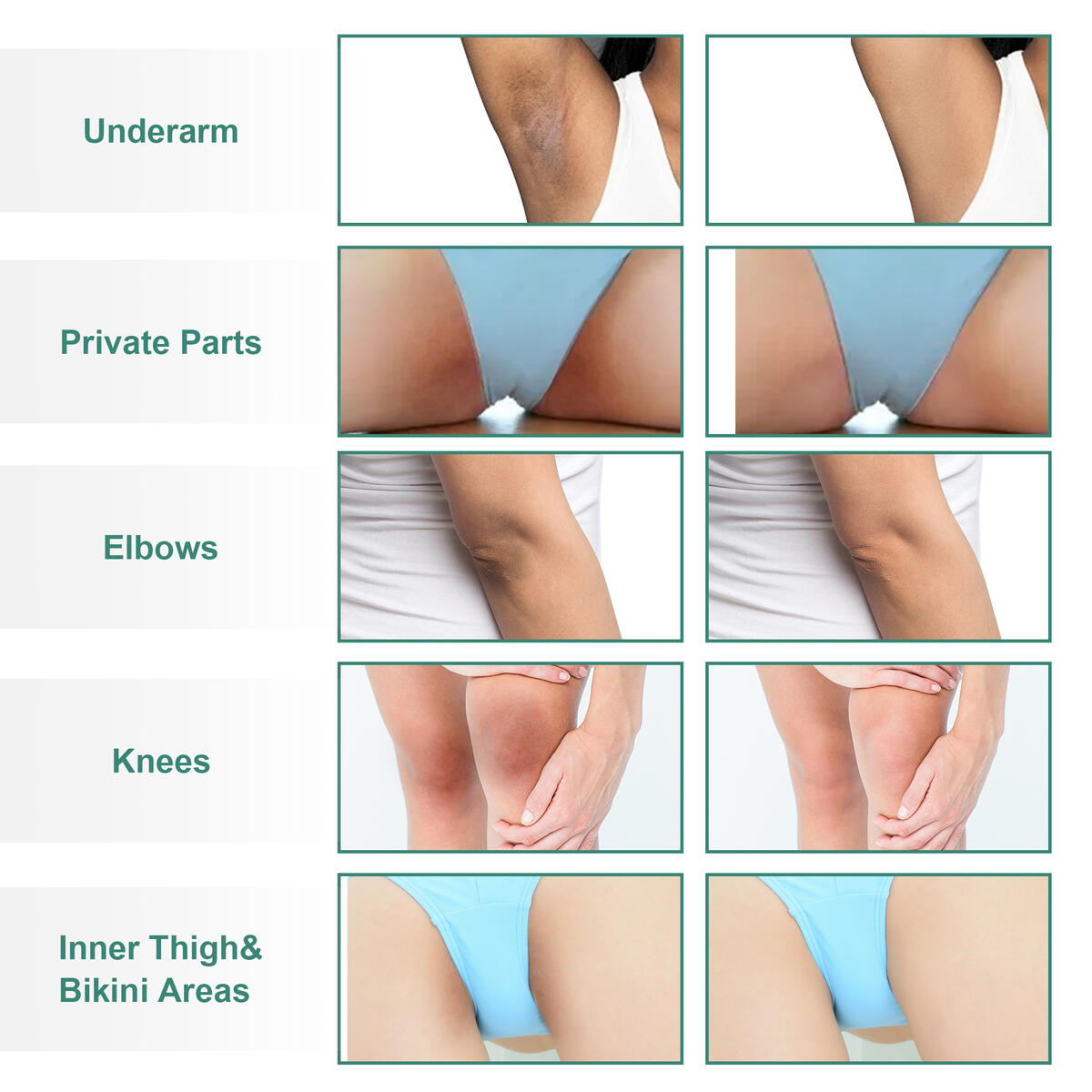 Lightening Cream For Intimate Areas Cashback Rebates - RebateKey