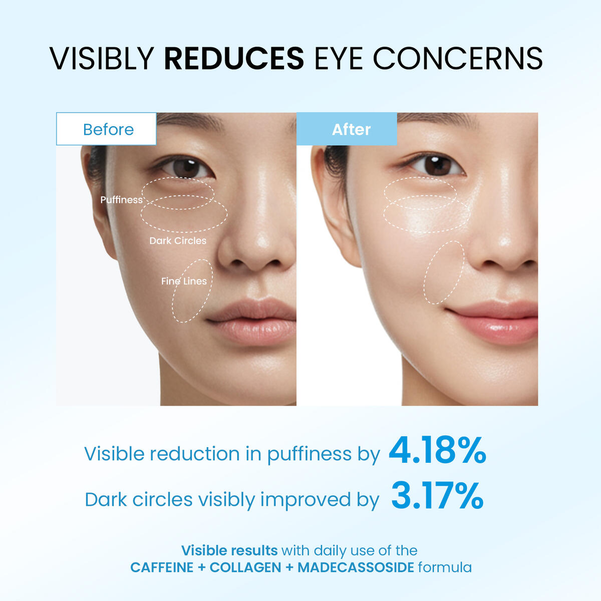 Caffeine Eye Cream 30 Cashback Rebate - RebateKey