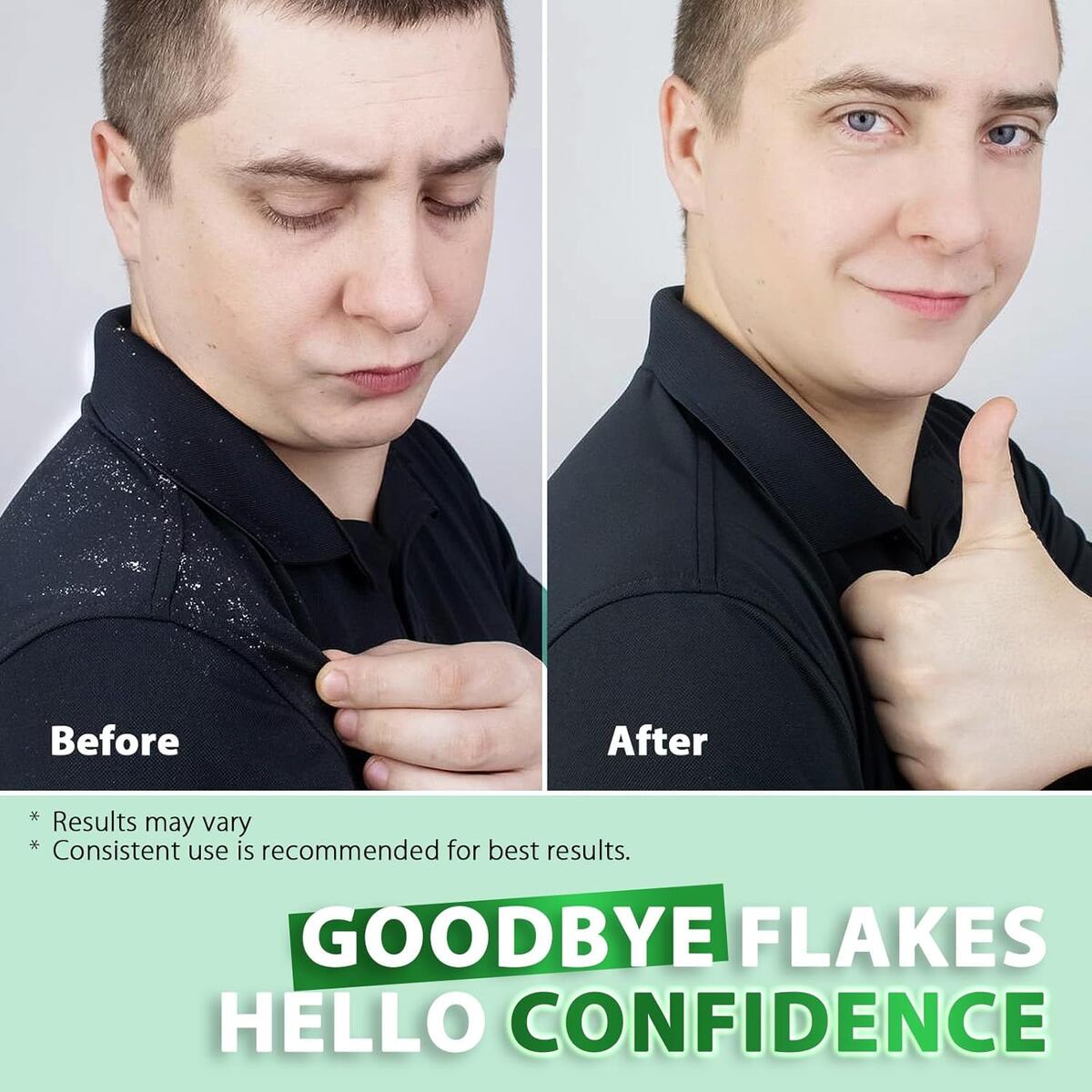 Shampoo For Folliculitis And Psoriasis Rebates - RebateKey