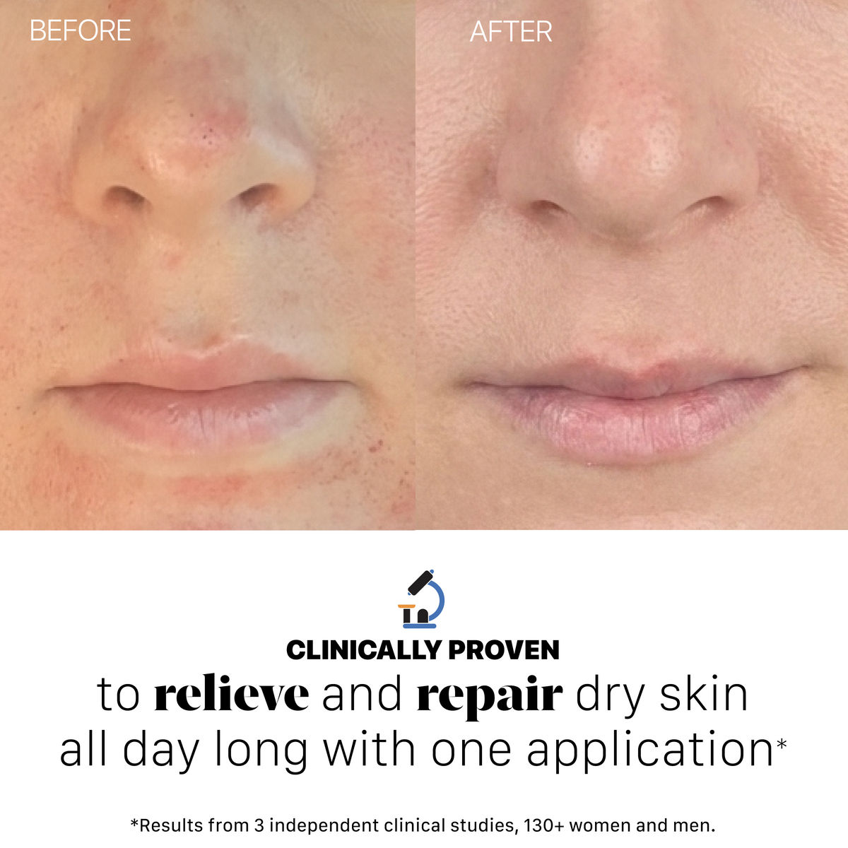 Eczema Cream 003 Cashback Rebate - RebateKey