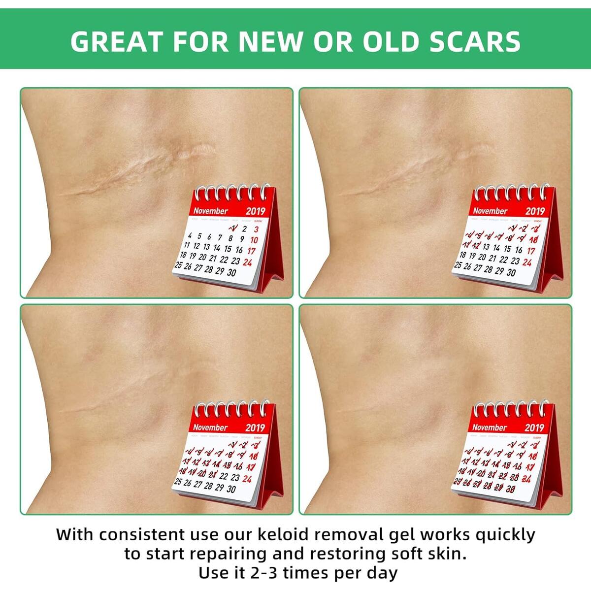 Keloid Bump Removal Cashback Rebates - RebateKey