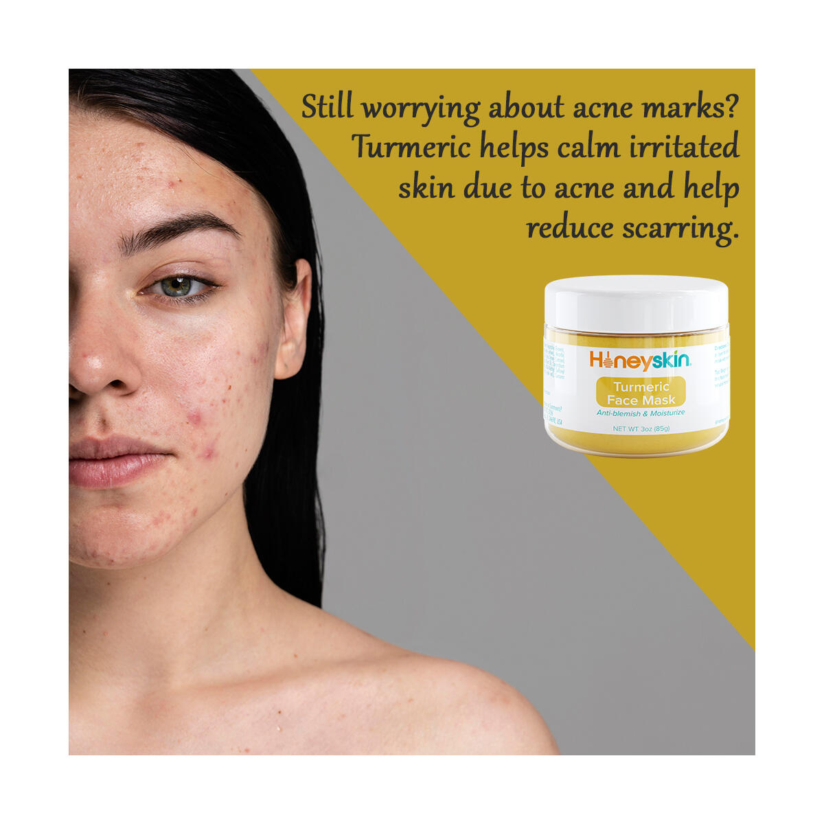 Turmeric Face Mask Cashback Rebate - RebateKey