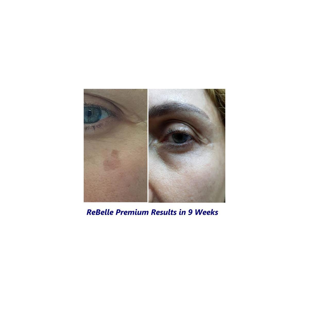 Rebelle Skin Lightening Whitening Cream For Anti Pigmentation For Dark Spots Rebates - RebateKey