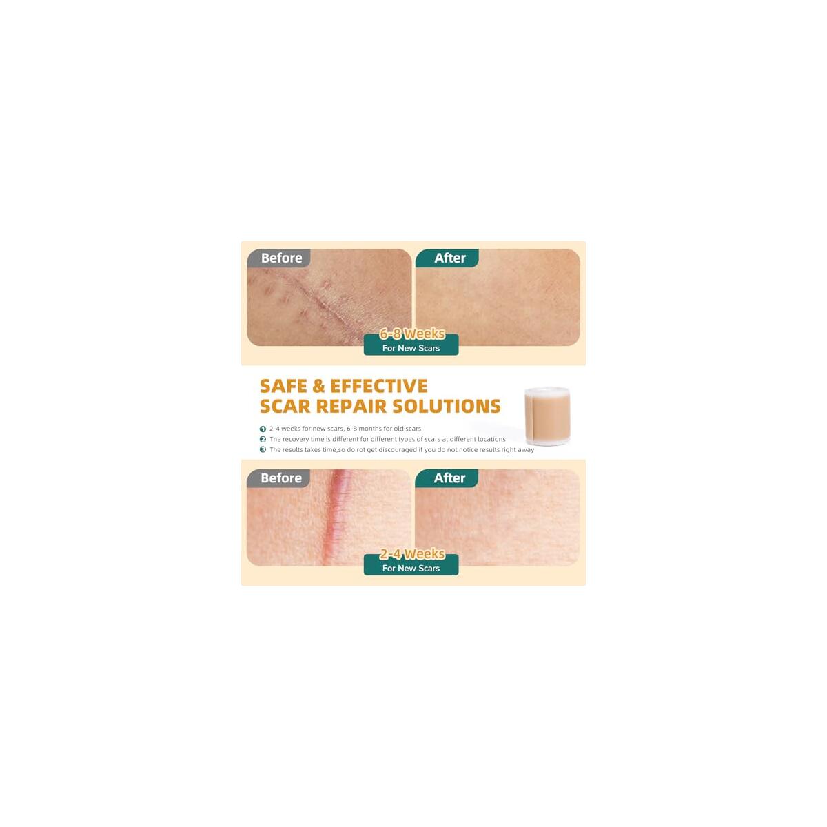 Silicone Scar Tape 2 Rebate - RebateKey