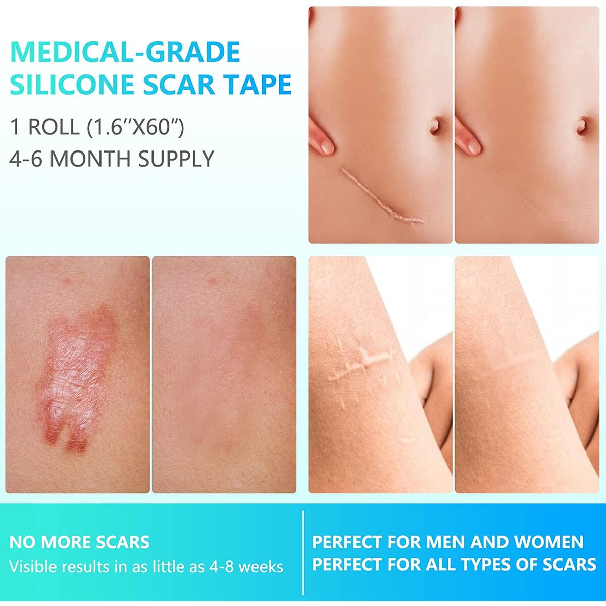 Silicone Scar Sheets Silicone Rebates - RebateKey