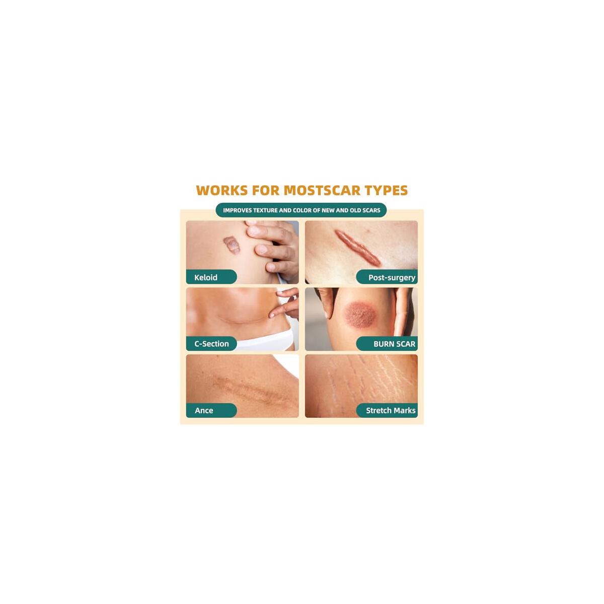 Silicone Scar Tape 2 Rebate - RebateKey
