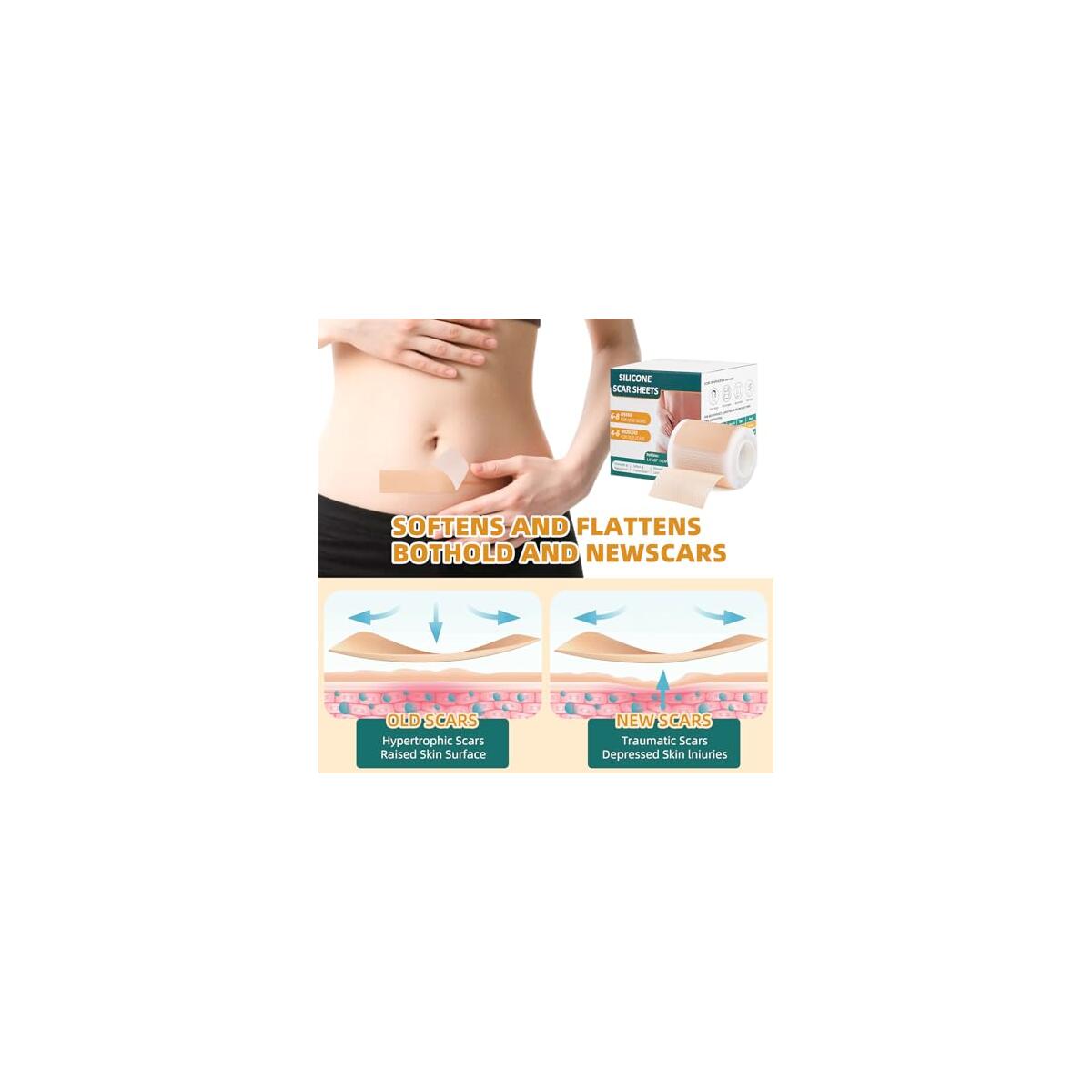 Silicone Scar Tape 2 Rebate - RebateKey