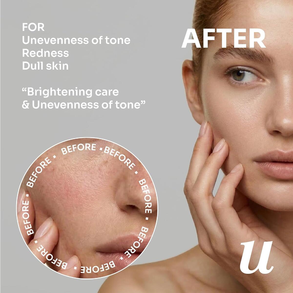 Ulook Even Tone Serum Cashback Rebate - RebateKey