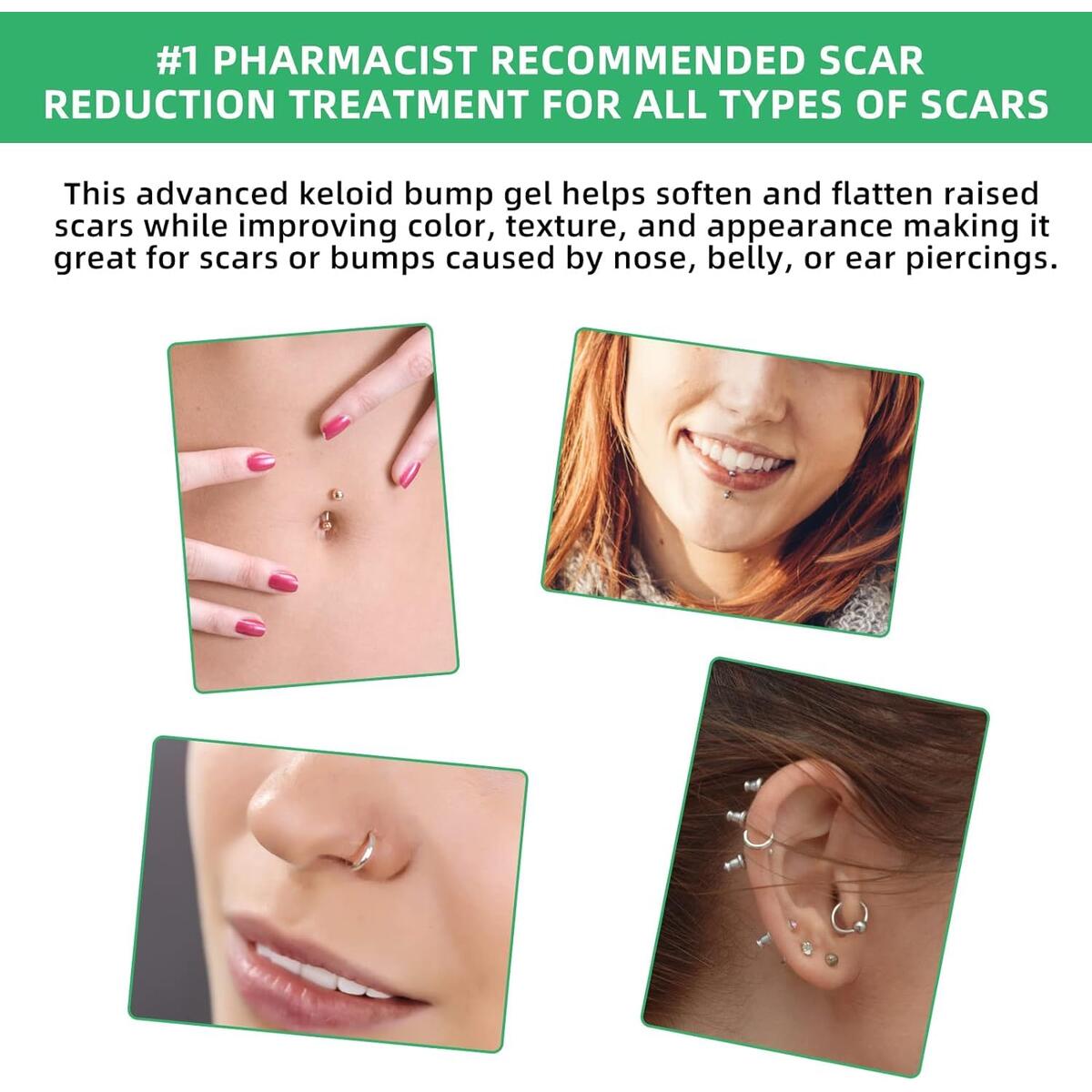 Keloid Bump Removal Cashback Rebates - RebateKey