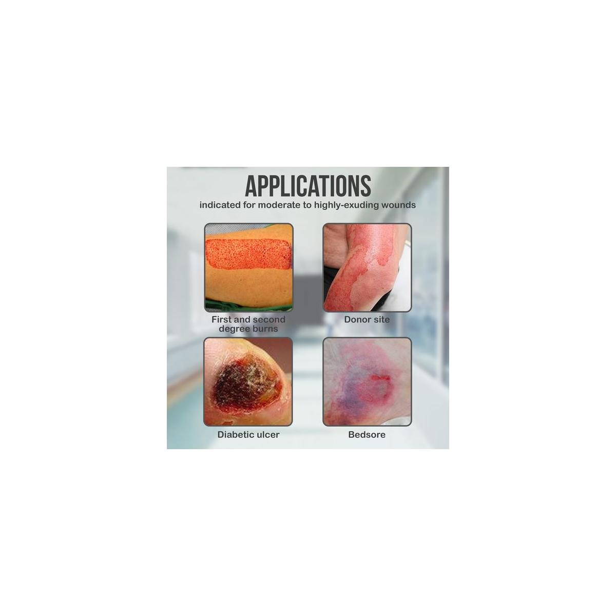 Pack Of 5 6x6 Inches Silicone Foam Dressing Sacral Foam Dressing Bordered Cash Back - RebateKey