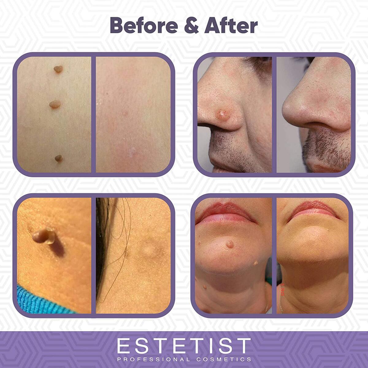 Tag Remover Cashback Rebate - RebateKey