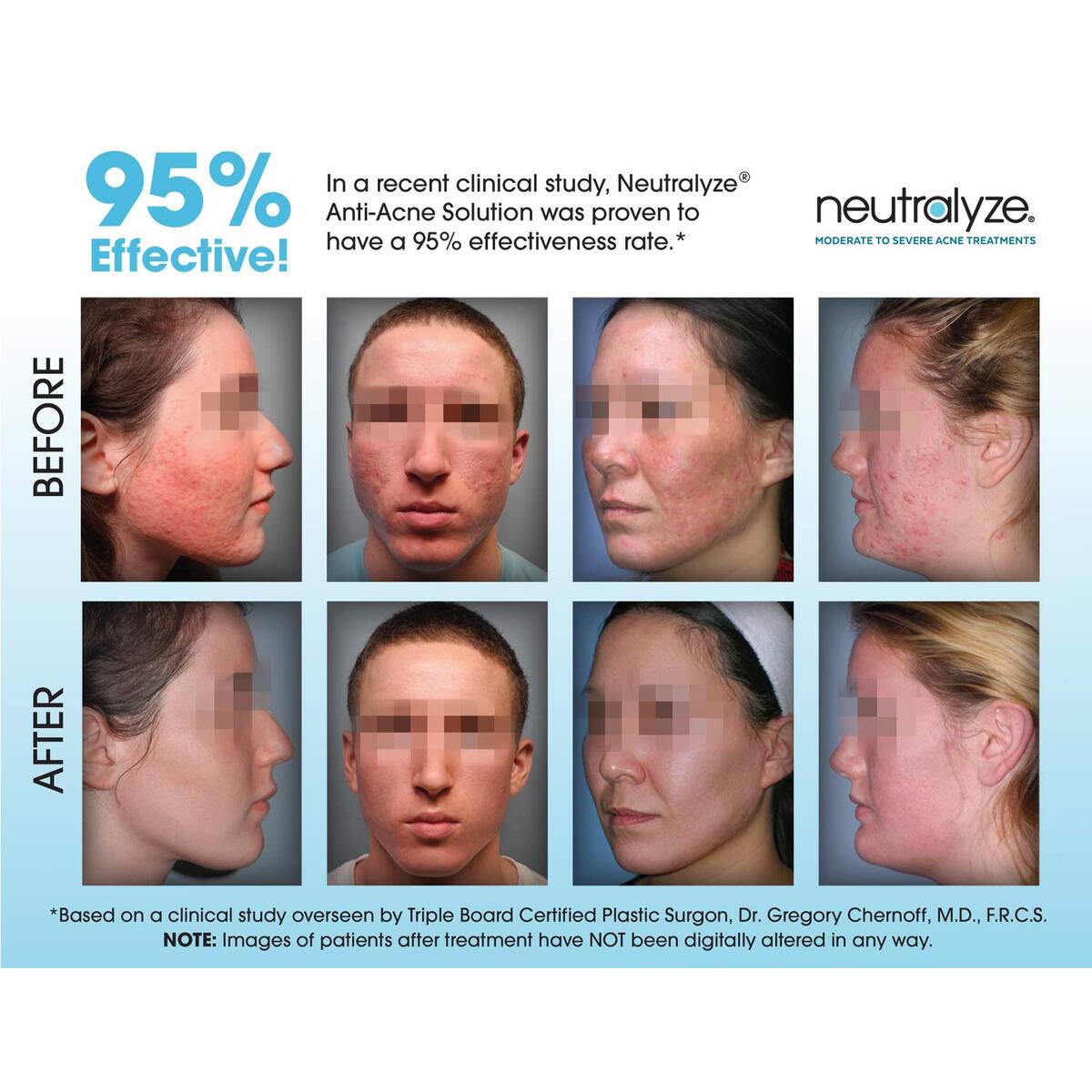 Neutralyze Exfoliating Pads Cashback - RebateKey