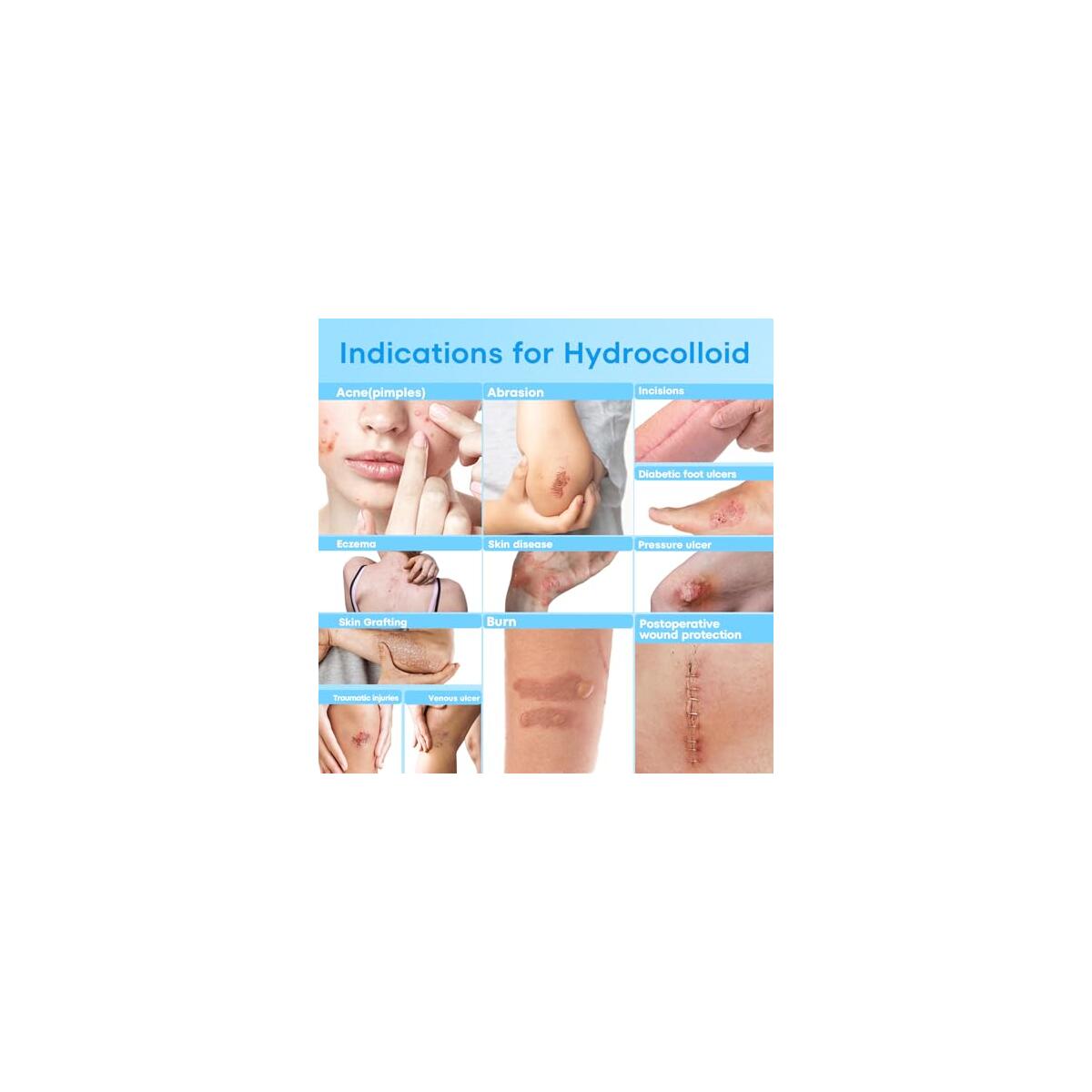 Wifamy Hydrocolloid Roll Rebates - RebateKey