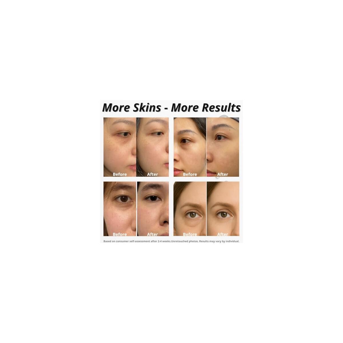 Caffeine Eye Serum 2 Cashback Rebate - RebateKey