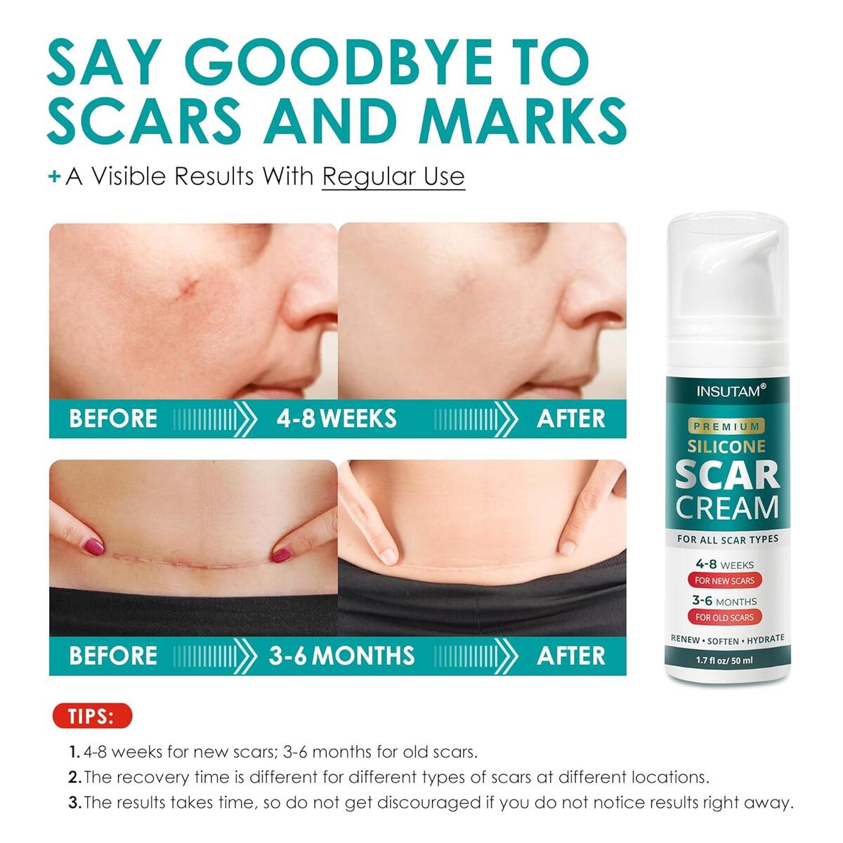 Silicone Scar Gel 7 Rebate - RebateKey