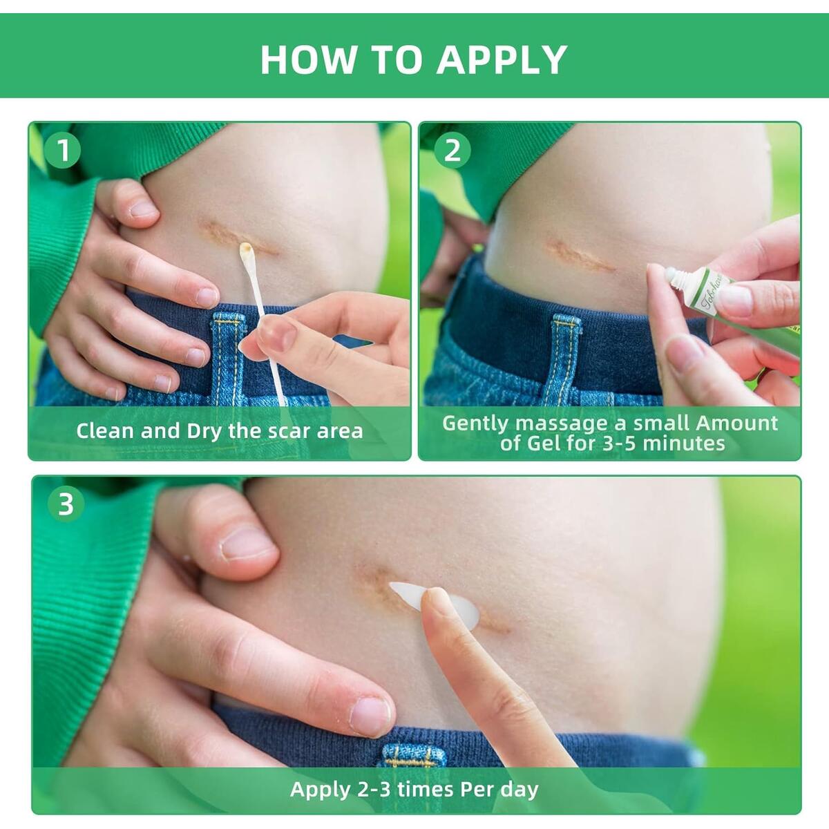 Keloid Bump Removal Cashback Rebates - RebateKey