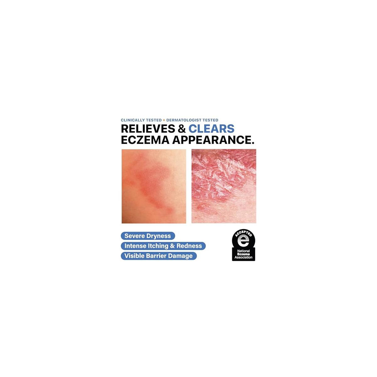 Dr Arsy Eczema Cashback Rebate - RebateKey