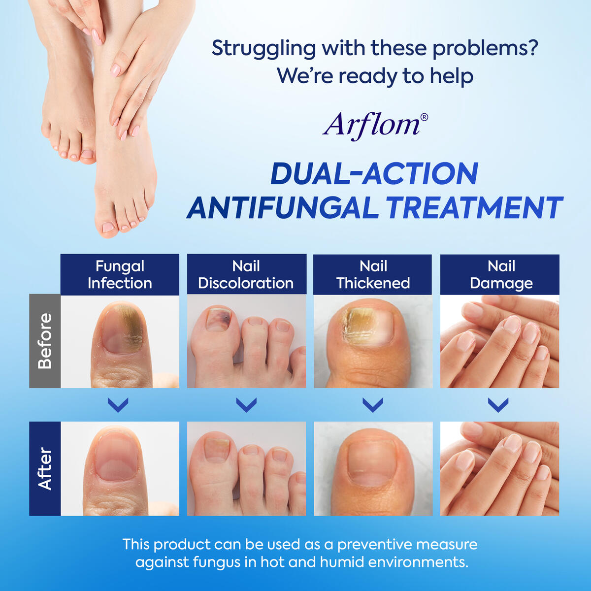 Toenail Fungus Treatment Extra Strength 1 Cash Back - RebateKey
