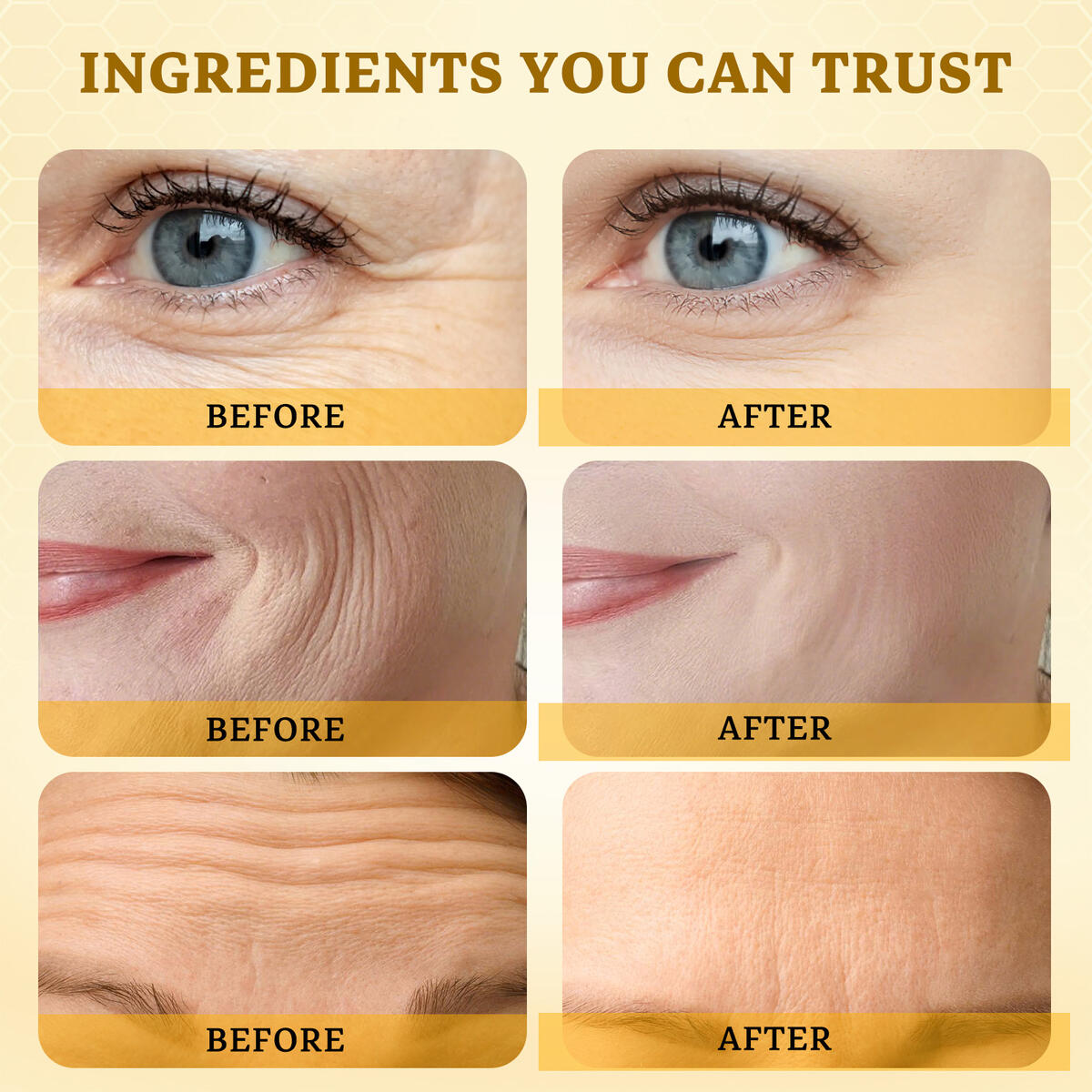 Anti Wrinkle Face Cream Cashback - RebateKey